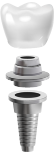 Parts